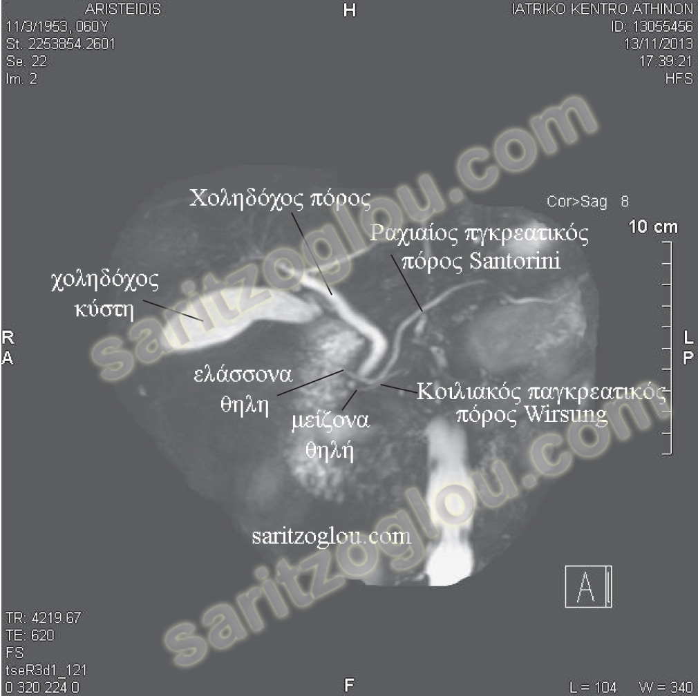 divisummrcp divisummrcp