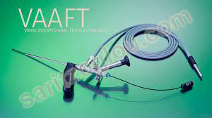 κύστη κόκκυγος