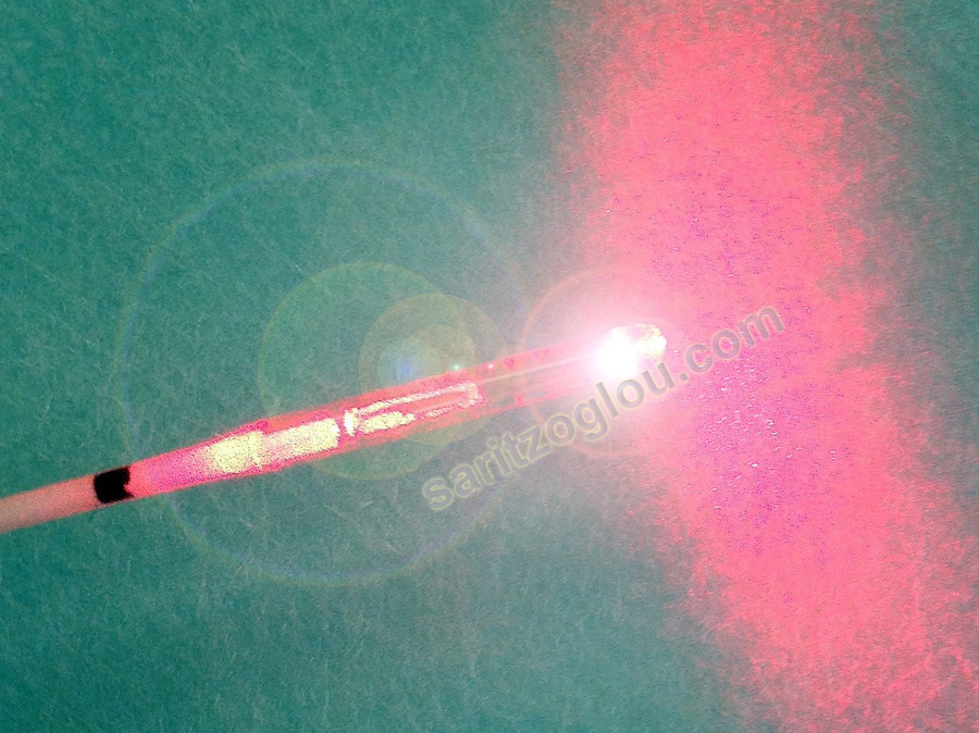 κύστη κόκκυγος